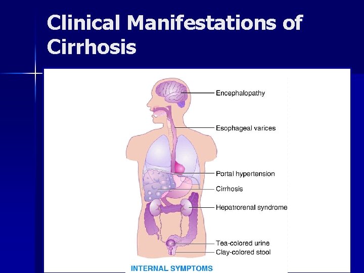 Clinical Manifestations of Cirrhosis © 2004, 2002 Elsevier Inc. All rights reserved. 