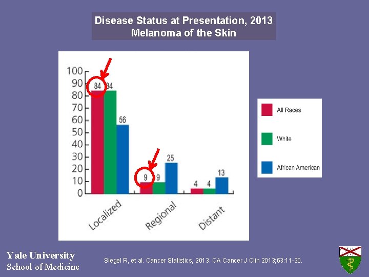Disease Status at Presentation, 2013 Melanoma of the Skin Yale University School of Medicine