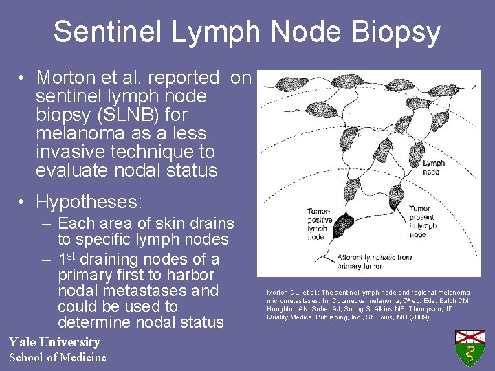 Sentinel Lymph Node Biopsy • Morton et al. reported on sentinel lymph node biopsy