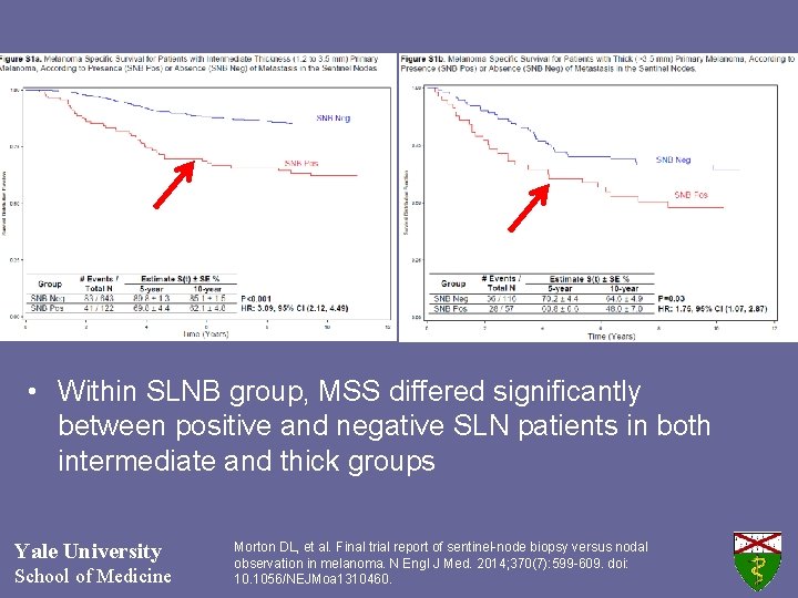  • Within SLNB group, MSS differed significantly between positive and negative SLN patients