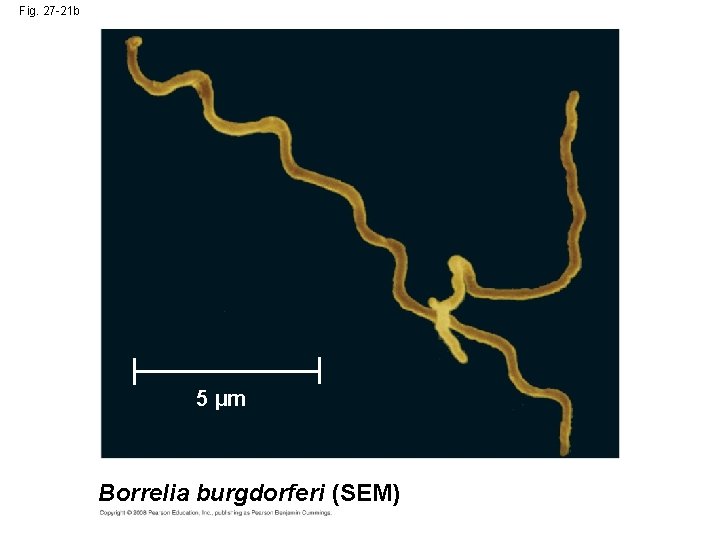 Fig. 27 -21 b 5 µm Borrelia burgdorferi (SEM) 