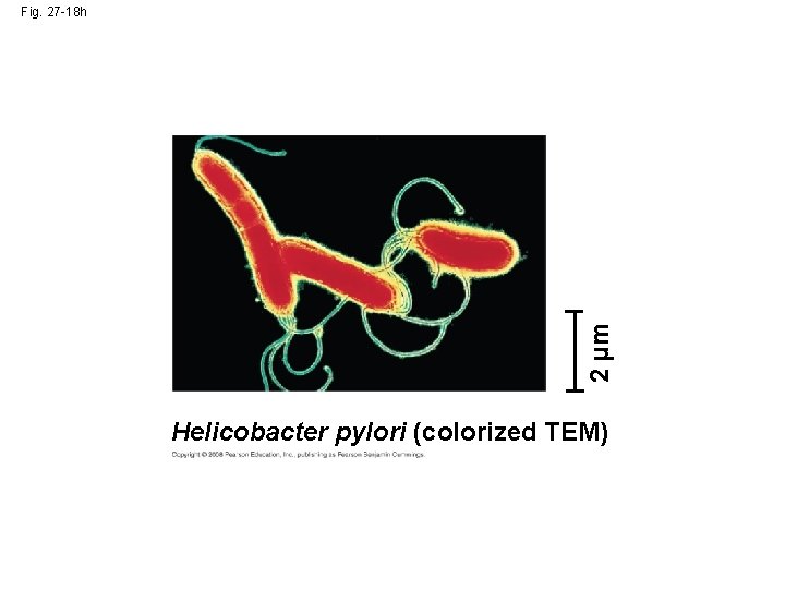 2 µm Fig. 27 -18 h Helicobacter pylori (colorized TEM) 