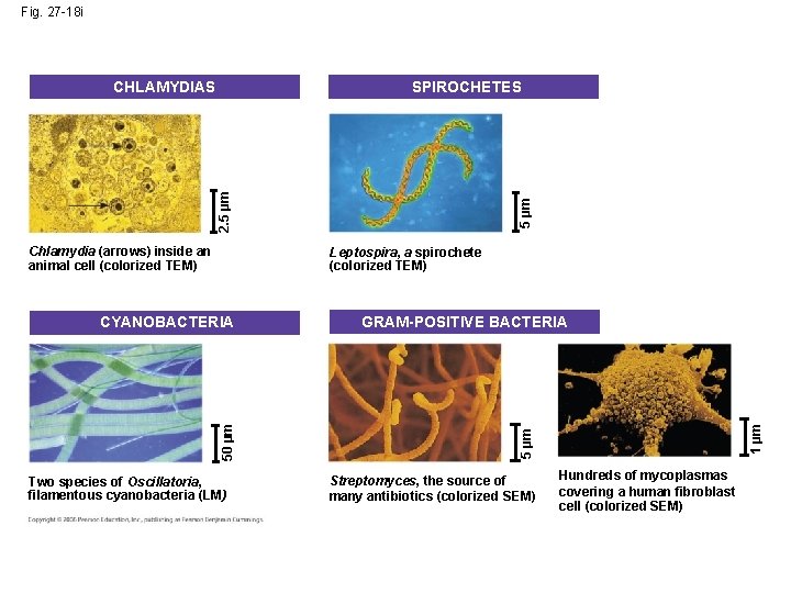 Fig. 27 -18 i SPIROCHETES Chlamydia (arrows) inside an animal cell (colorized TEM) 5