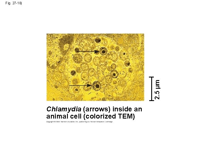 2. 5 µm Fig. 27 -18 j Chlamydia (arrows) inside an animal cell (colorized