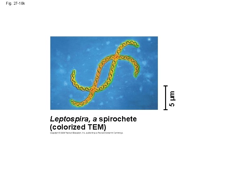 5 µm Fig. 27 -18 k Leptospira, a spirochete (colorized TEM) 