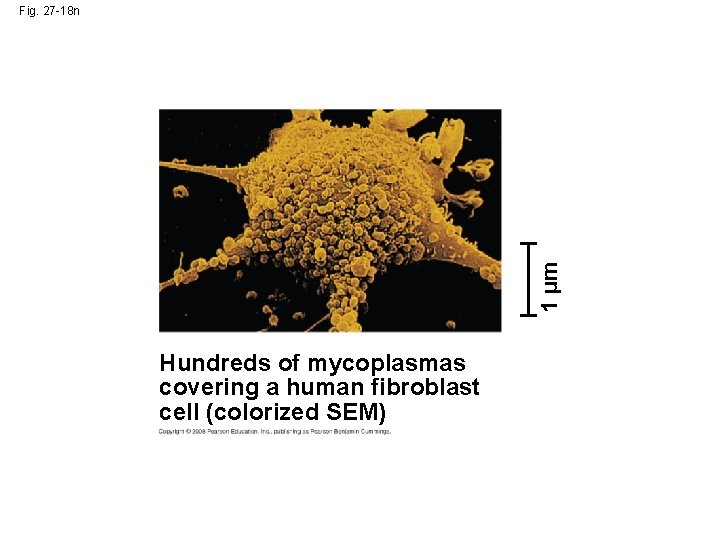 1 µm Fig. 27 -18 n Hundreds of mycoplasmas covering a human fibroblast cell