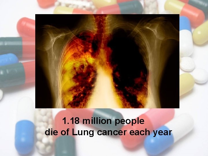 1. 18 million people die of Lung cancer each year 