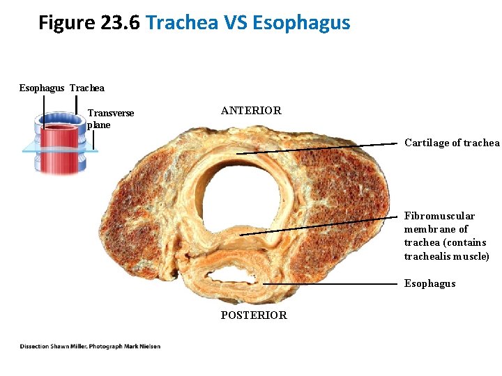 Figure 23. 6 Trachea VS Esophagus Trachea Transverse plane ANTERIOR Cartilage of trachea Fibromuscular