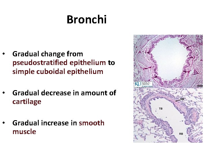 Bronchi • Gradual change from pseudostratified epithelium to simple cuboidal epithelium • Gradual decrease