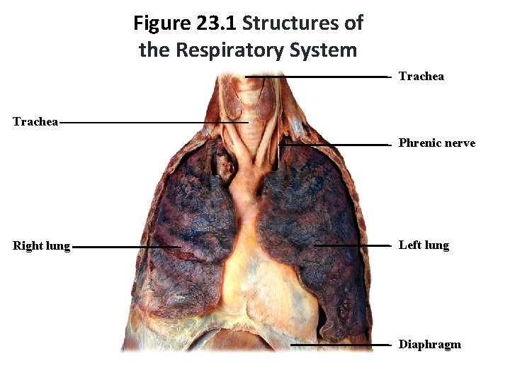 Figure 23. 1 Structures of the Respiratory System Trachea Phrenic nerve Right lung Left