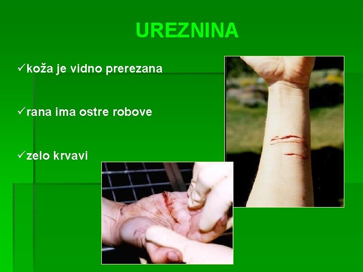 UREZNINA ükoža je vidno prerezana ürana ima ostre robove üzelo krvavi 