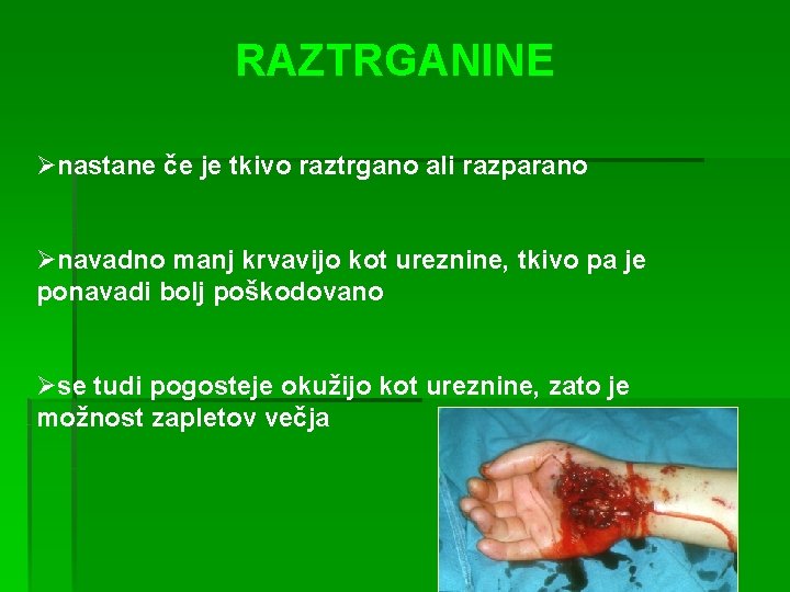 RAZTRGANINE Ønastane če je tkivo raztrgano ali razparano Ønavadno manj krvavijo kot ureznine, tkivo