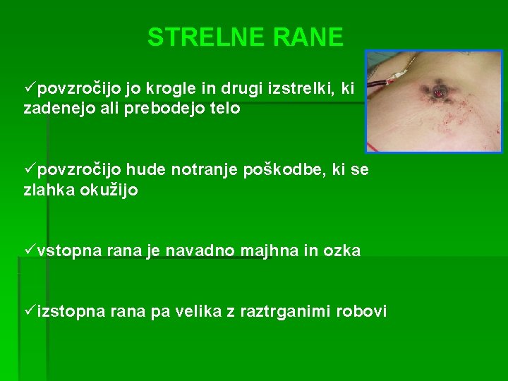 STRELNE RANE üpovzročijo jo krogle in drugi izstrelki, ki zadenejo ali prebodejo telo üpovzročijo