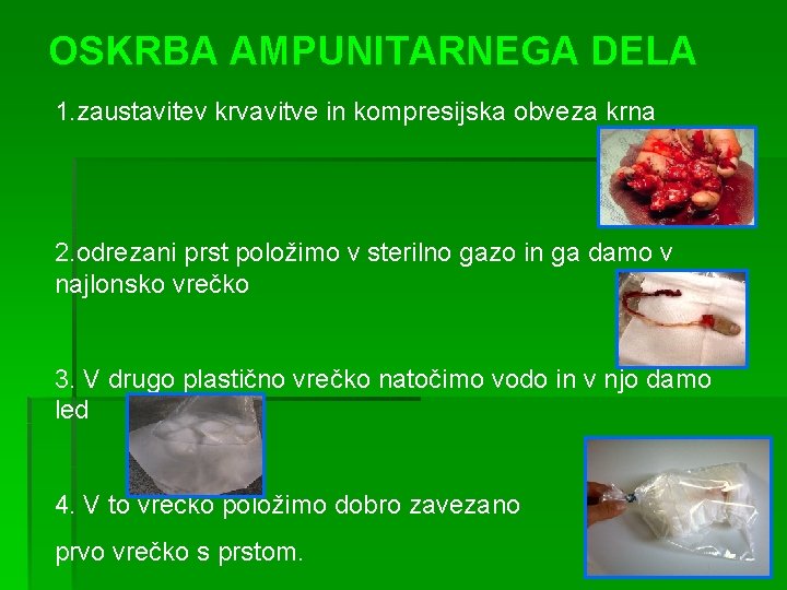OSKRBA AMPUNITARNEGA DELA 1. zaustavitev krvavitve in kompresijska obveza krna 2. odrezani prst položimo