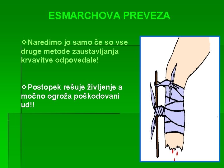 ESMARCHOVA PREVEZA v. Naredimo jo samo če so vse druge metode zaustavljanja krvavitve odpovedale!