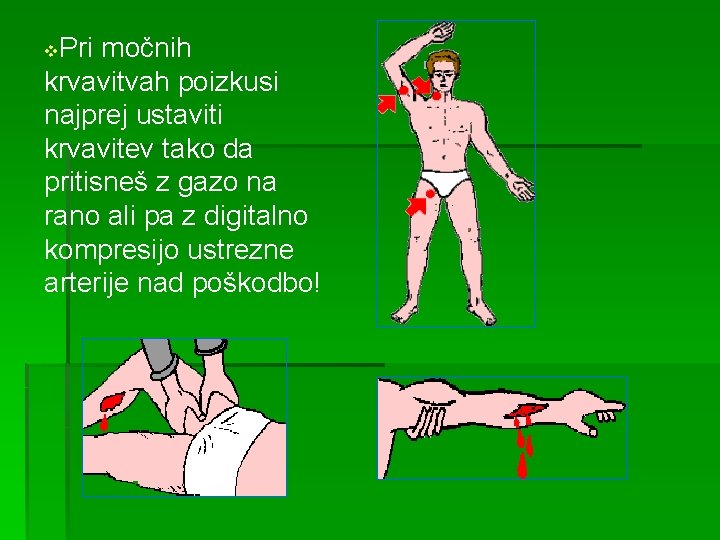 Pri močnih krvavitvah poizkusi najprej ustaviti krvavitev tako da pritisneš z gazo na rano