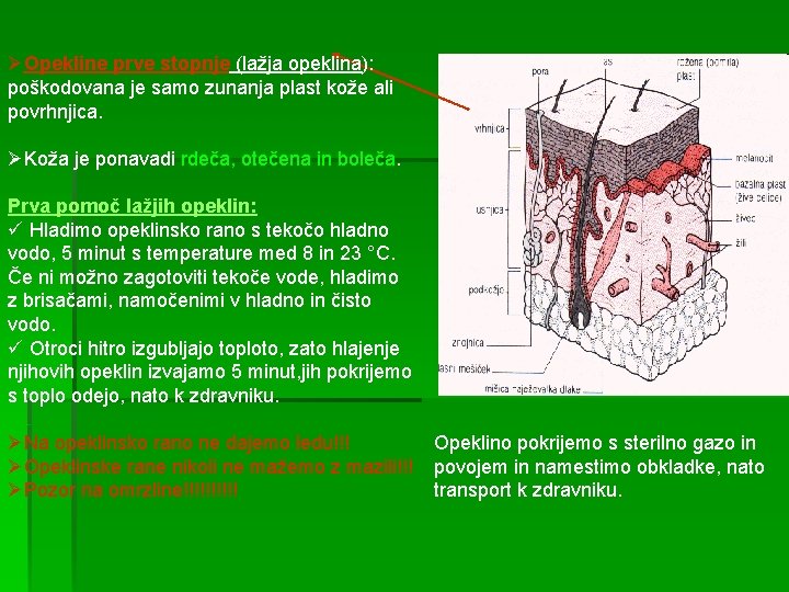 ØOpekline prve stopnje (lažja opeklina): poškodovana je samo zunanja plast kože ali povrhnjica. ØKoža