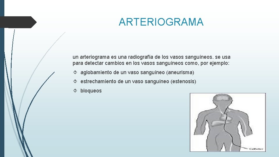 ARTERIOGRAMA un arteriograma es una radiografía de los vasos sanguíneos. se usa para detectar