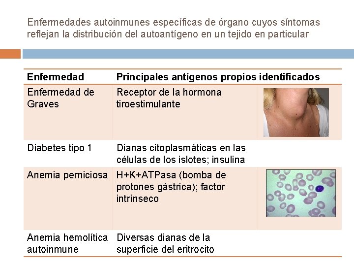 Enfermedades autoinmunes específicas de órgano cuyos síntomas reflejan la distribución del autoantígeno en un