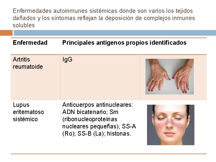 Enfermedades autoinmunes sistémicas donde son varios los tejidos dañados y los síntomas reflejan la