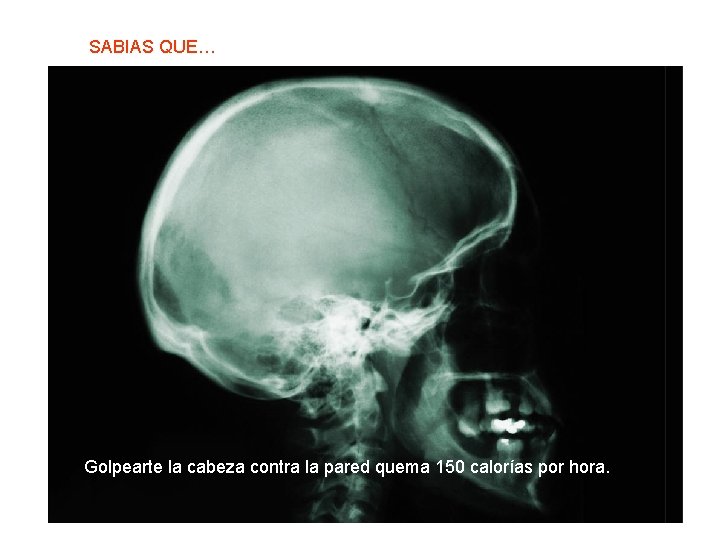 SABIAS QUE… Golpearte la cabeza contra la pared quema 150 calorías por hora. 