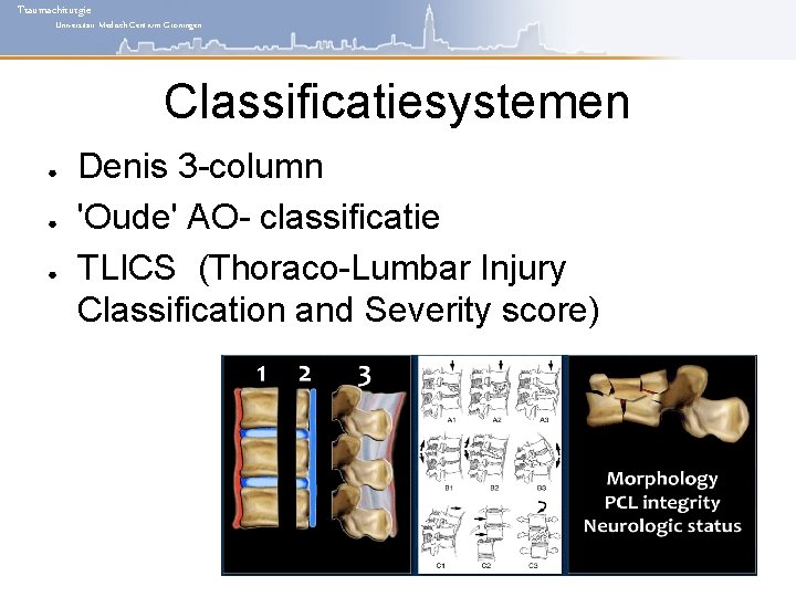 Traumachirurgie Universitair Medisch Centrum Groningen Classificatiesystemen ● ● ● Denis 3 -column 'Oude' AO-