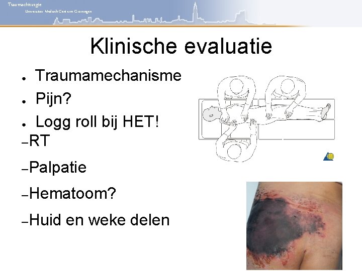 Traumachirurgie Universitair Medisch Centrum Groningen Klinische evaluatie Traumamechanisme ● Pijn? ● Logg roll bij