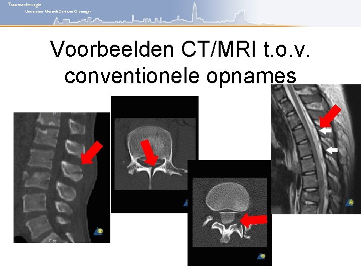 Traumachirurgie Universitair Medisch Centrum Groningen Voorbeelden CT/MRI t. o. v. conventionele opnames 