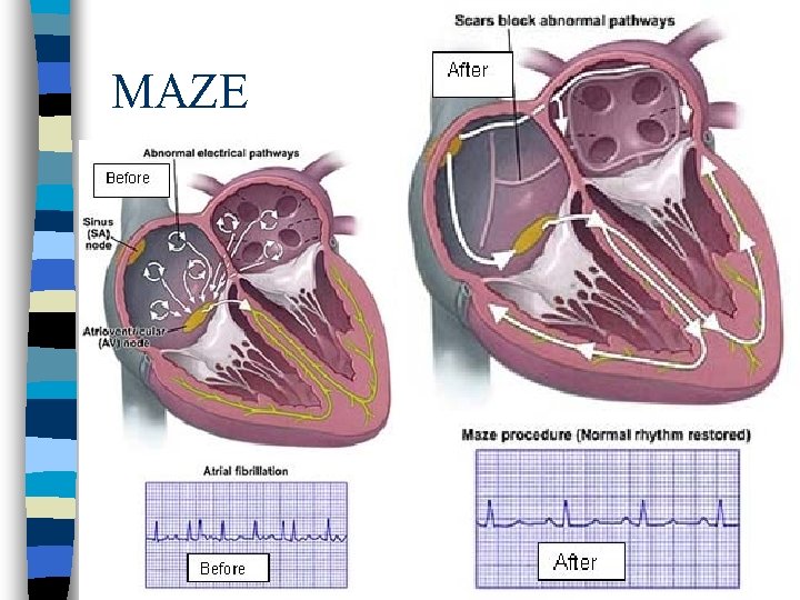 MAZE 