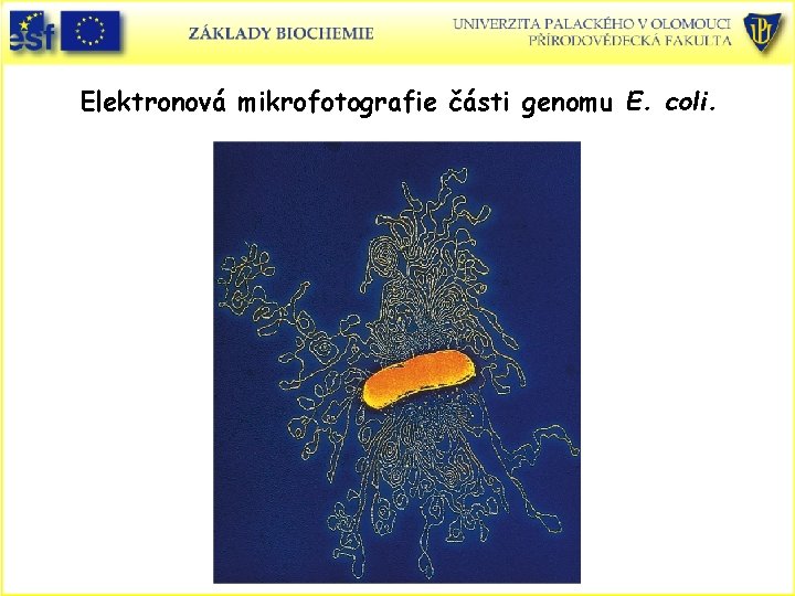 Elektronová mikrofotografie části genomu E. coli. 