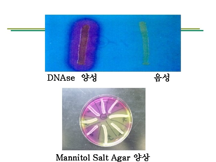 DNAse 양성 Mannitol Salt Agar 양상 음성 