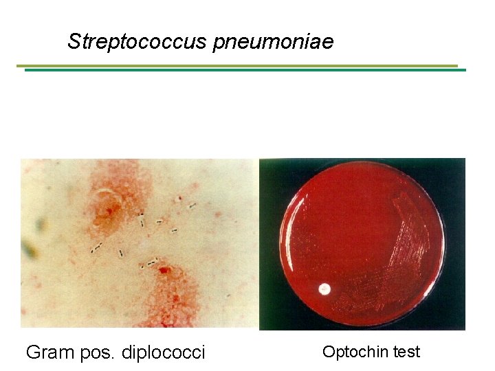 Streptococcus pneumoniae Gram pos. diplococci Optochin test 