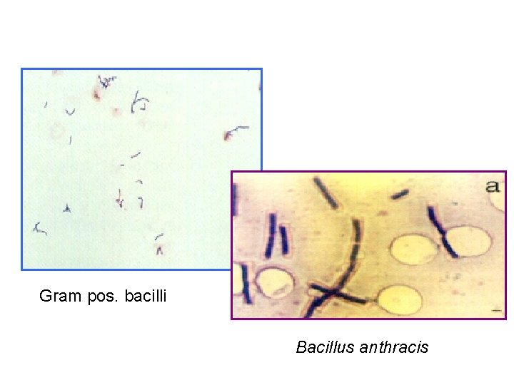Gram pos. bacilli Bacillus anthracis 