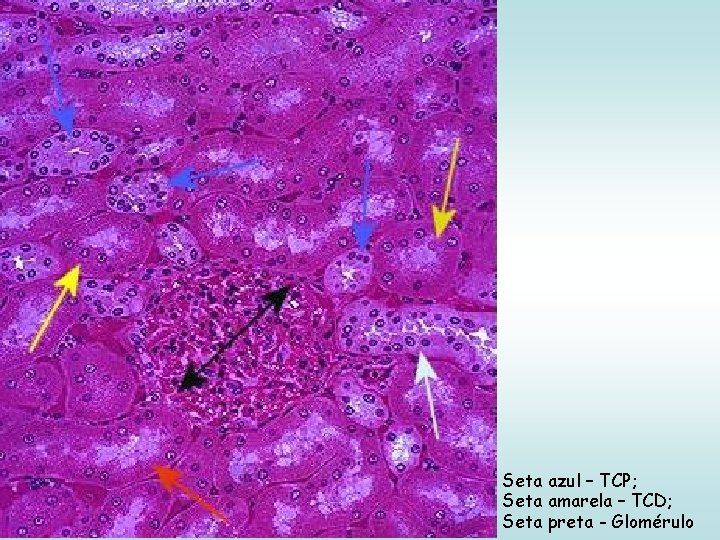 Seta azul – TCP; Seta amarela – TCD; Seta preta - Glomérulo 