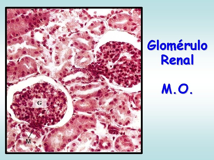 Glomérulo Renal M. O. G 