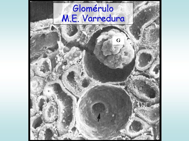 Glomérulo M. E. Varredura G 