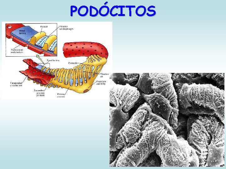 PODÓCITOS 