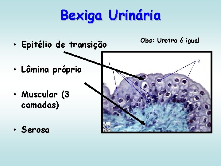 Bexiga Urinária • Epitélio de transição • Lâmina própria • Muscular (3 camadas) •