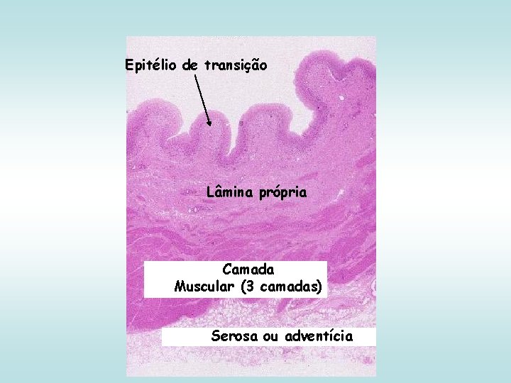 Epitélio de transição Lâmina própria Camada Muscular (3 camadas) Serosa ou adventícia 