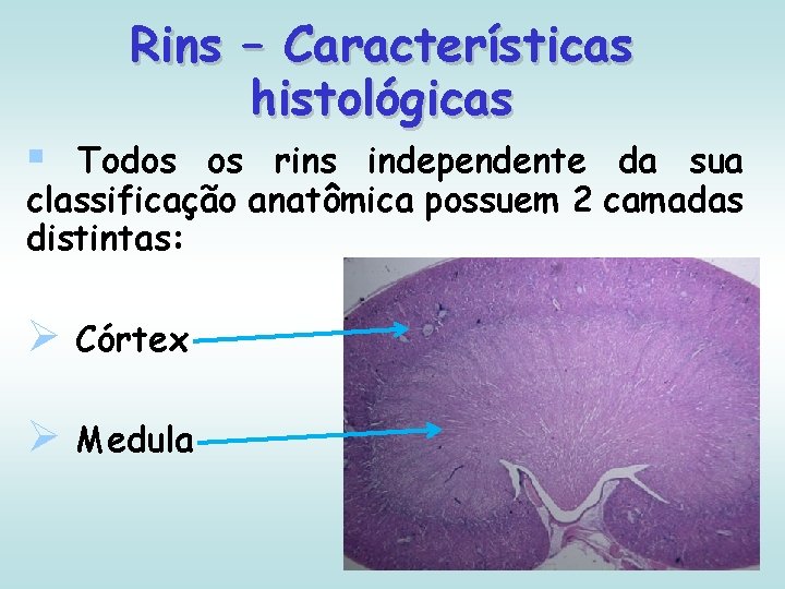 Rins – Características histológicas § Todos os rins independente da sua classificação anatômica possuem