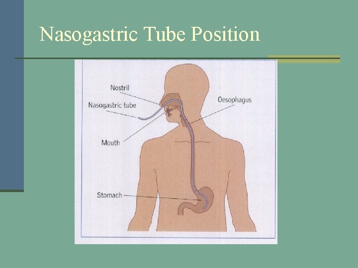Nasogastric Tube Position 
