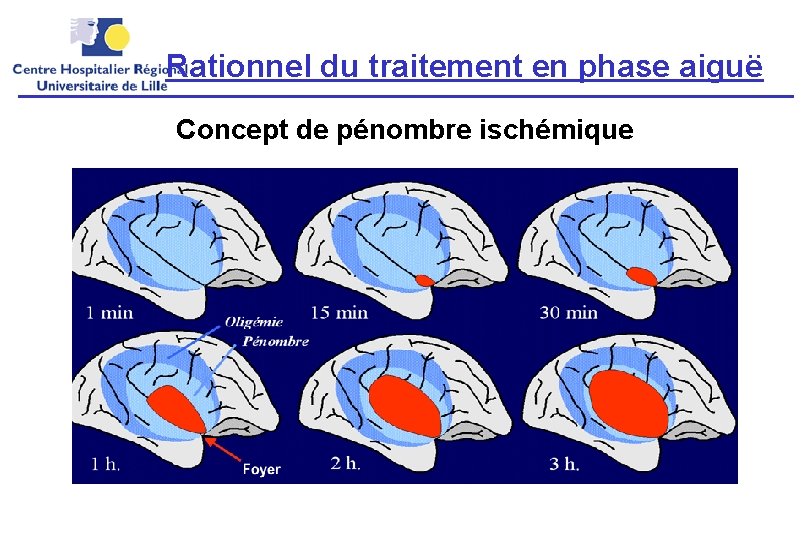 Rationnel du traitement en phase aiguë Concept de pénombre ischémique 