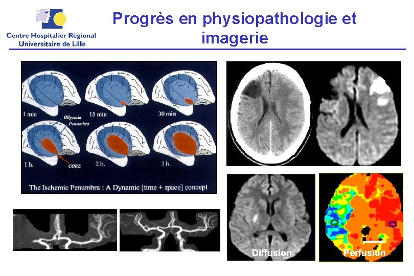 Progrès en physiopathologie et imagerie Diffusion Perfusion 