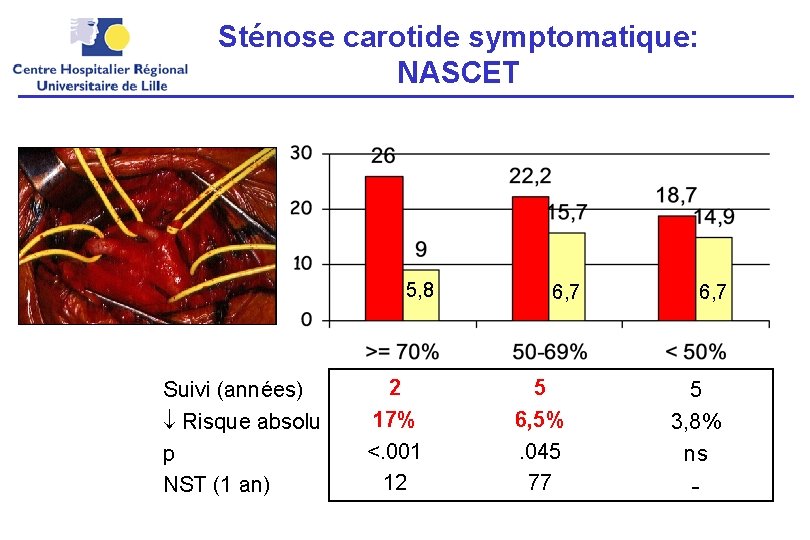 Sténose carotide symptomatique: NASCET 5, 8 Suivi (années) Risque absolu p NST (1 an)