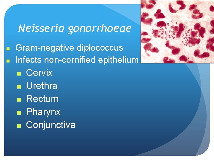 Neisseria gonorrhoeae n n Gram-negative diplococcus Infects non-cornified epithelium n n n Cervix Urethra