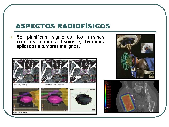 ASPECTOS RADIOFÍSICOS l Se planifican siguiendo los mismos criterios clínicos, físicos y técnicos aplicados