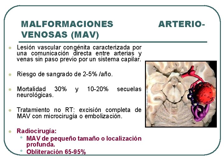 MALFORMACIONES VENOSAS (MAV) ARTERIO- l Lesión vascular congénita caracterizada por una comunicación directa entre