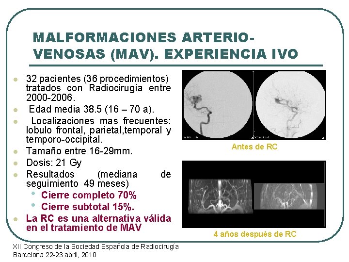 MALFORMACIONES ARTERIOVENOSAS (MAV). EXPERIENCIA IVO l l l l 32 pacientes (36 procedimientos) tratados