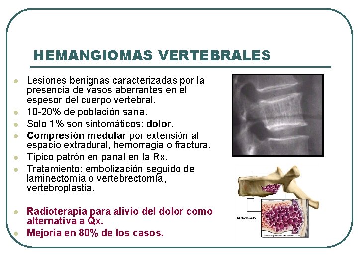 HEMANGIOMAS VERTEBRALES l l l l Lesiones benignas caracterizadas por la presencia de vasos