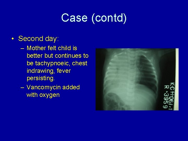 Case (contd) • Second day: – Mother felt child is better but continues to